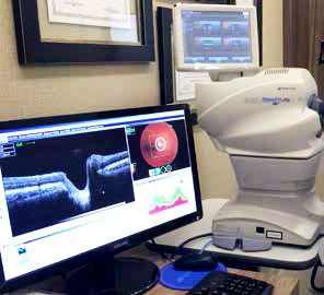 A tomografia de coerência óptica